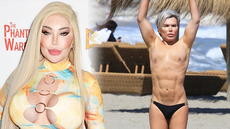 Jessica Alves přitvrzuje: Životně důležitý orgán má z 80% pryč, cena za plastiky narostla do obřích rozměrů