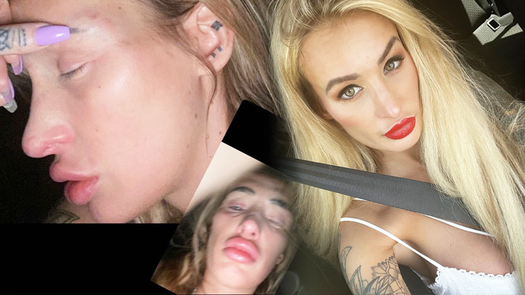 Daisy Lee popsala brutální domácí násilí svého přítele: V těhotenství mě kopal do břicha