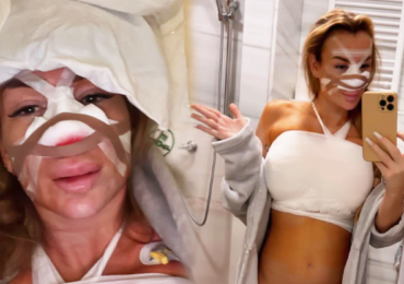 Královna plastik Eva Feuereislová podstoupila tři náročné zákroky najednou: Museli ji spravit i tam dole