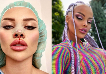 První česká Barbie Gabriel Jiráčková má za sebou další plastiku: Nosík ve tvaru diamantu jako od Mattela