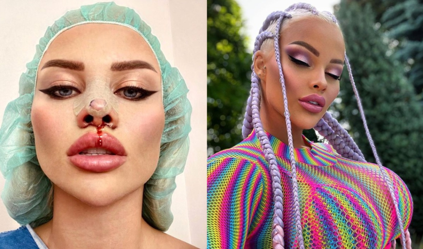 První česká Barbie Gabriel Jiráčková má za sebou další plastiku: Nosík ve tvaru diamantu jako od Mattela