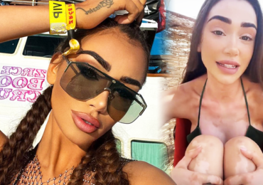 Veronica Biasiol se slzami v očích přiznala nemoc, kterou roky skrývala: Už to nechci tajit vzkázala