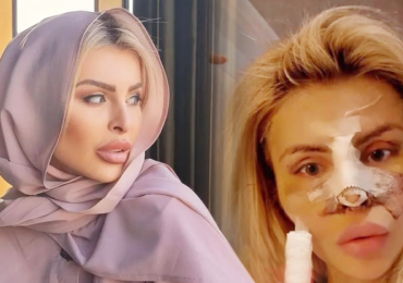 Bolestivá plastika Lely Vémoly v Íránu: Finální výsledek až za několik měsíců