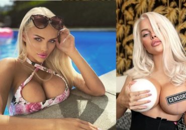 Ňadra velikosti 10 byla málo: Česká Barbie Gabriel Jiráčková šla znova pod kudlu a odnesla si zvláštní jizvu