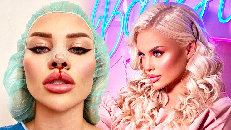 Milovnice plastické chirurgie Gabriel Jiráčková: Jak by vypadala, kdyby ze dne na den přestala se všemi zákroky?