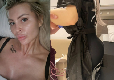 Lela Vémola po operaci, která trvala 6 hodin: Můj zadek měl převis, bylo to nutné, vzkázala