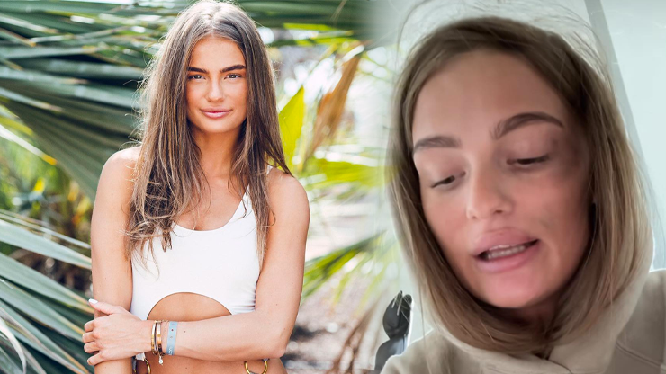 Partnerka Macha Muradova vyděsila fanoušky: Obličej Sabiny hyzdí obří modřina pod okem