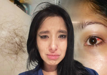 Herečku z filmů pro dospělé Nikol napadl přítel: Vytrhané vlasy, krev, podlitiny a útěk bez oblečení