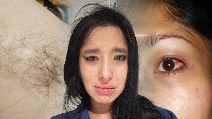 Herečku z filmů pro dospělé Nikol napadl přítel: Vytrhané vlasy, krev, podlitiny a útěk bez oblečení