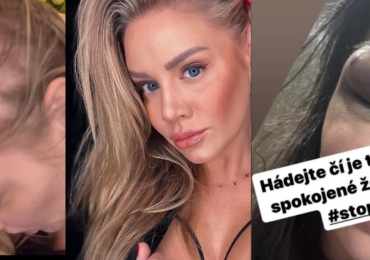 Dívčí válka: Influencerka Michaela Jonáš popsala brutální napadení, vláčeli mě po asfaltu a vytrhali vlasy