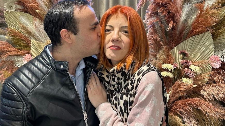 Shopaholicadel o domácím násilí na příteli: Vysvětlila, jak se na jeho tváři objevila fialová modřina