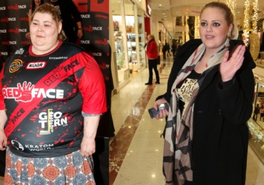 Droběna z Red Face objasnila existenci nevzhledných strupů po těle: Podstoupí operaci jako Charlotte Štiková