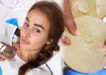 Tělo Daisy Lee odmítlo silikony, ty praskly a musely ven: Teď budou vytahaná a svislá, pláče